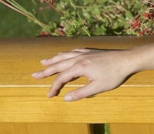 In base alle condizioni del legno bisogna individuare il trattamento - Accessories by J.F. AMONN